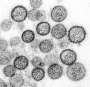 imagen hantavirus microscópico