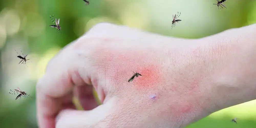 picadura de mosquito tigre